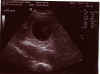 ultraschall091201.jpg (47744 Byte)