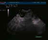 ultraschall_r_litter.jpg (43707 Byte)