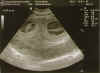 ultraschall.jpg (88252 Byte)